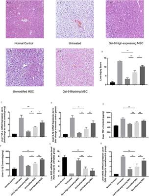 Galectin-9 Mediates the Therapeutic Effect of Mesenchymal Stem Cells on Experimental Endotoxemia